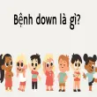 Bệnh down là gì? Sự thật ít ai biết về hội chứng này