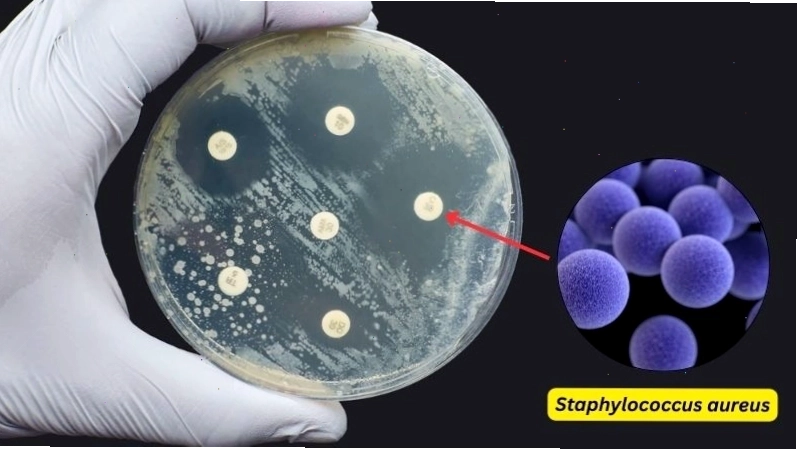Hoa chuông thể hiện tiềm năng ức chế chủng vi khuẩn Staphylococcus aureus