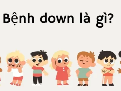 Bệnh down là gì? Sự thật ít ai biết về hội chứng này